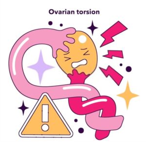 Over Torsiyonu Nasıl Tedavi Edilir