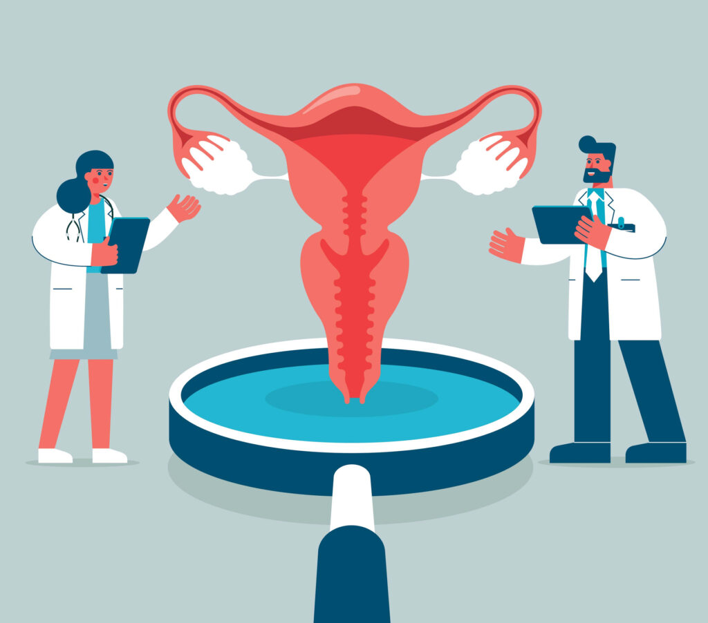 Miyom Tedavi Yöntemleri: İlaç Tedavisi Mi, Cerrahi Müdahale mi?