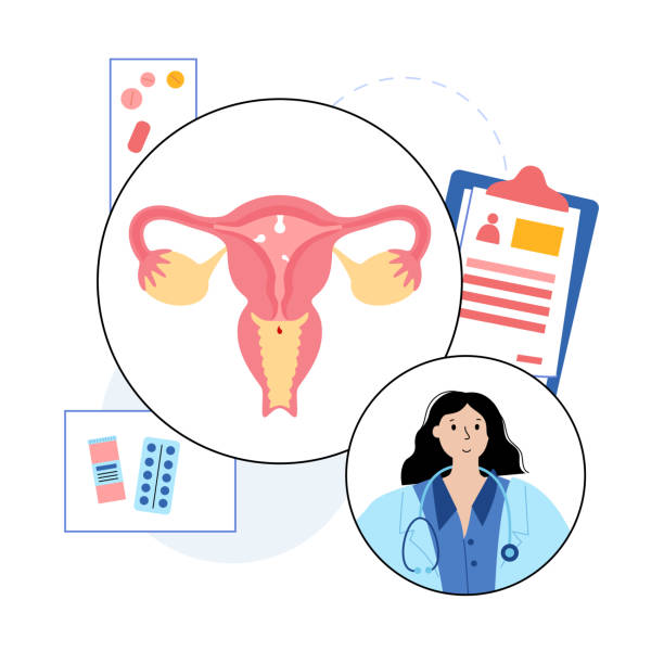 Rahim Polipleri ve Kısırlık: Gebe Kalmayı Nasıl Etkiler?